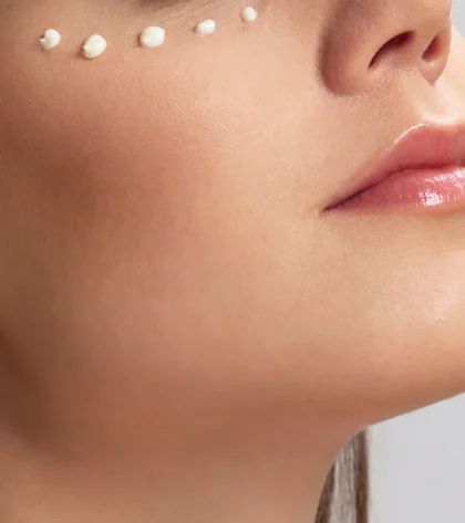 Acne after treatment