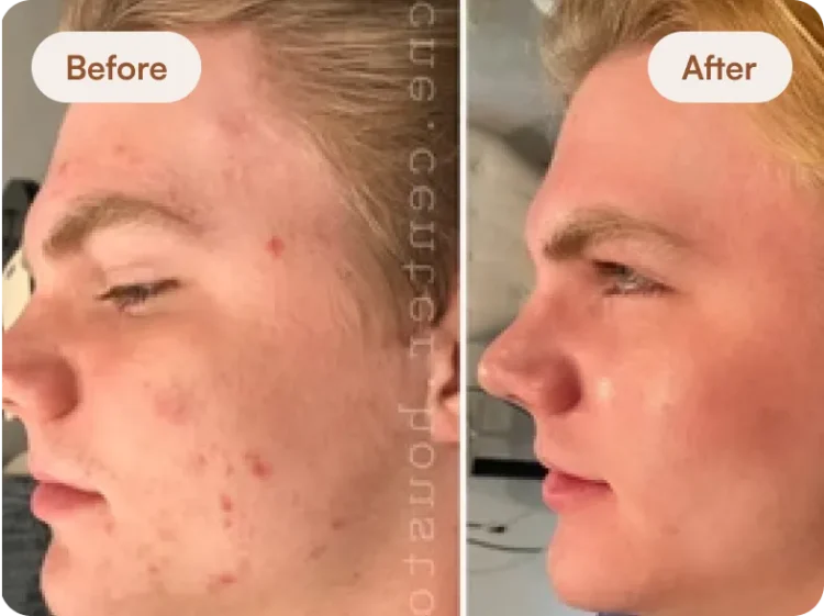 before-after-7