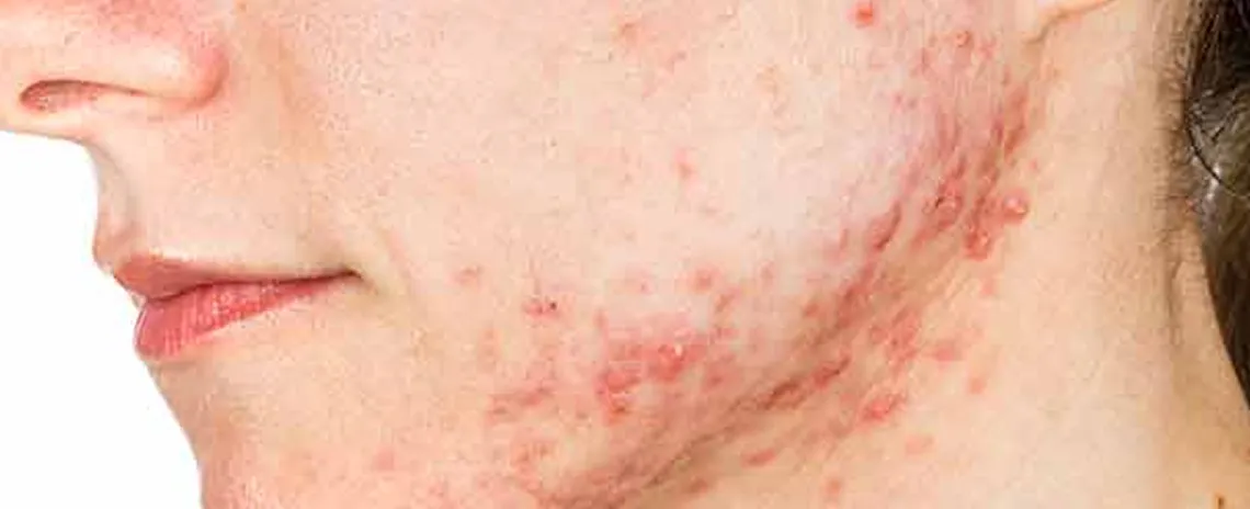close-up-skin-pores-face-care-routine-1