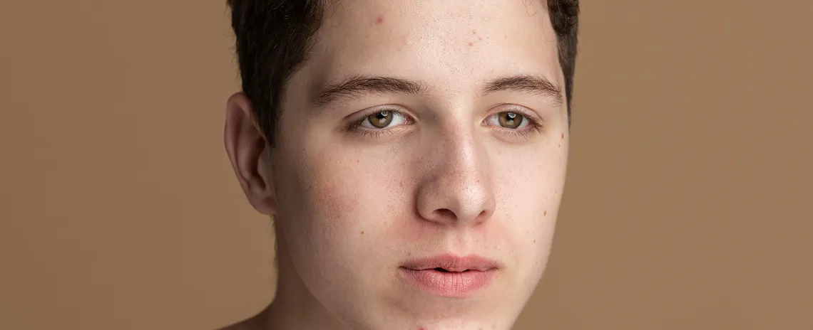 close-up-skin-pores-face-care-routine-2