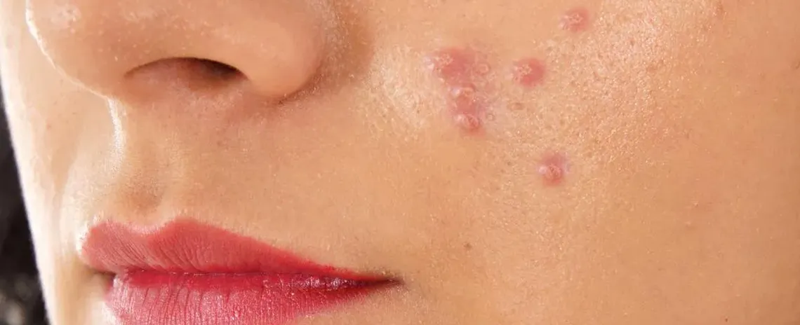 close-up-skin-pores-face-care-routine-3