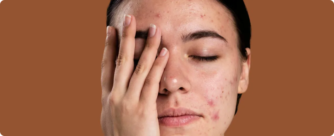 close-up-skin-pores-face-care-routine-4