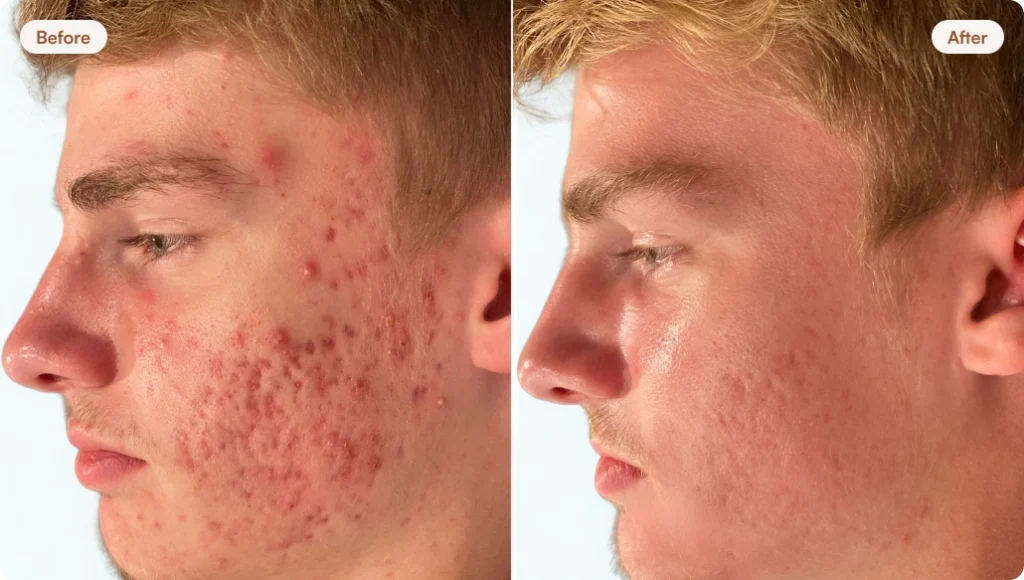 before-after-home