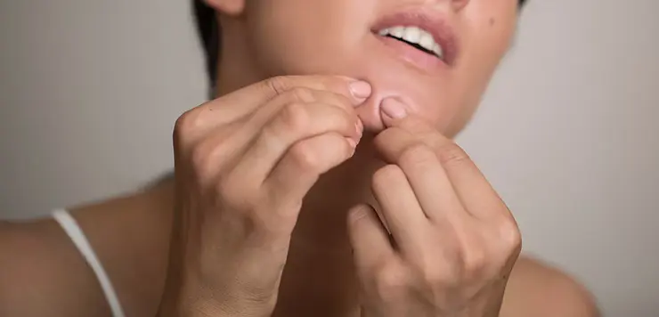 avoid-acne-picking-consequences